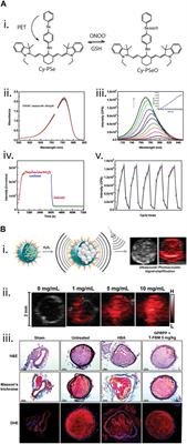 Review: Nanomaterials for Reactive Oxygen Species Detection and Monitoring in Biological Environments